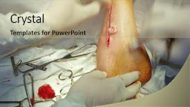  Presentation with wound care - Presentation having moment before stitching operative wound background and a coral colored foreground