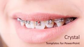  Presentation with medical concept - Cool new presentation with mouth with brackets braces backdrop and a  colored foreground
