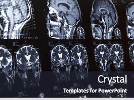 Neurology Mri Of Human Brain PPT template 90 | CrystalGraphics