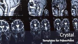  Presentation with brain mri - Cool new presentation theme with mri of human brain tomography backdrop and a tawny brown colored foreground