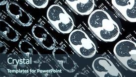  Presentation with mri brain - Cool new slide deck with mri of human brain backdrop and a ocean colored foreground