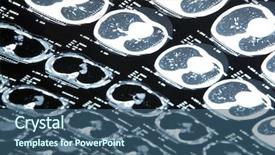  Presentation with brain mri - Presentation design enhanced with mri of human brain background and a ocean colored foreground