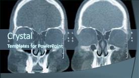  Presentation with mri brain - Presentation design featuring mri scan image of brain background and a ocean colored foreground