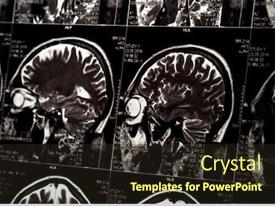Mri Scan Of Human Brain PPT template 31 | CrystalGraphics