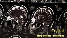  Presentation with mri brain - Theme having mri-scan-of-human-brain background and a wine colored foreground