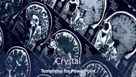  Presentation with mri brain - Slide deck featuring mri-scan-of-human-brain background and a ocean colored foreground