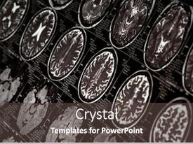 Mri Scan Of Human Brain PPT template 40 | CrystalGraphics
