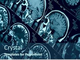  Presentation with brain - PPT layouts enhanced with mri-scan-of-human-brain background and a ocean colored foreground