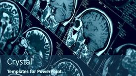  Presentation with brain mri - PPT layouts enhanced with mri-scan-of-human-brain background and a ocean colored foreground