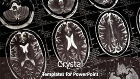  Presentation with brain mri - PPT theme consisting of mri-scan-of-human-brain background and a tawny brown colored foreground
