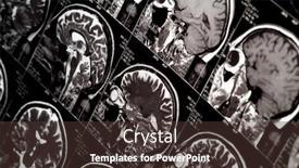  Presentation with brain mri - Slide deck having mri-scan-of-human-brain background and a tawny brown colored foreground