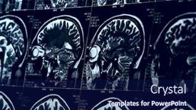  Presentation with brain mri - Presentation design consisting of mri-scan-of-human-brain background and a navy blue colored foreground