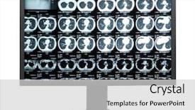  Presentation with brain injury - Audience pleasing slides consisting of mri tomogram of human brain backdrop and a light gray colored foreground