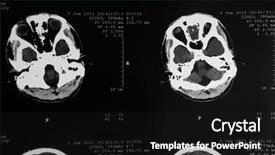  Presentation with mri brain - Presentation theme enhanced with mri tomogram of human brain background and a black colored foreground