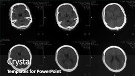  Presentation with mri brain - Colorful slides enhanced with mri tomogram of human brain backdrop and a dark gray colored foreground