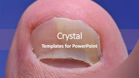  Presentation with fungi - Colorful theme enhanced with nail suffering from fungus infection backdrop and a coral colored foreground