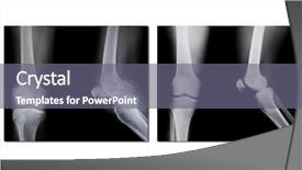  Presentation with normal - Colorful presentation enhanced with neck x rays - collection of x-ray broken knee backdrop and a gray colored foreground