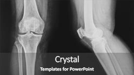  Presentation with normal - Cool new presentation with neck x rays - collection of x-ray normal knee backdrop and a dark gray colored foreground