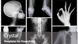  Presentation with x ray of a human - Amazing presentation theme having neck x rays - collection of x-ray backdrop and a dark gray colored foreground