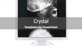  Presentation with medical concept - Audience pleasing presentation theme consisting of neck x rays - x-ray image and computer concept backdrop and a dark gray colored foreground