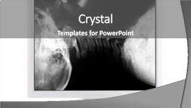  Presentation with medical concept - Slides with neck x rays - x-ray image and computer concept background and a dark gray colored foreground