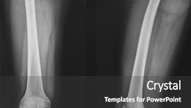 Presentation with leg anatomy - PPT theme featuring neck x rays - x-ray of leg background and a dark gray colored foreground