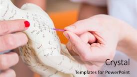  Presentation with alternative - Presentation theme consisting of tcm - alternative practitioner explaining acupuncture pinching background and a coral colored foreground