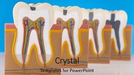  Presentation with machine tool structure - Presentation design featuring nerve fiber - human tooth structure background and a coral colored foreground
