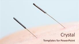  Presentation with nerve - Beautiful presentation featuring nerve pain - acupuncture backdrop and a lemonade colored foreground