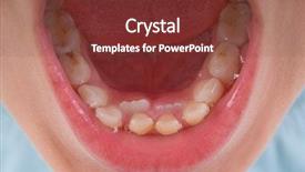  Presentation with teeth - Cool new PPT theme with new teeth of a kid backdrop and a tawny brown colored foreground