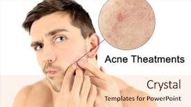  Presentation with skin care - PPT theme consisting of normal - skin care concept young man background and a lemonade colored foreground