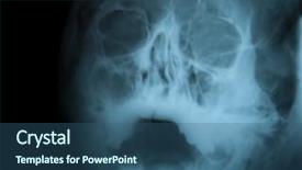  Presentation with xray - Cool new PPT theme with nose anatomi - skull xray image for medical backdrop and a ocean colored foreground