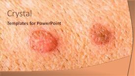  Presentation with healing - Audience pleasing PPT layouts consisting of nurse-cleanses-a-healing-wound backdrop and a lemonade colored foreground