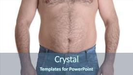  Presentation with obesity - Cool new theme with obesity surgery - adult man in jeans backdrop and a  colored foreground