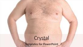  Presentation with patients and weight loss - Slides enhanced with obesity surgery - fat man on white background background and a lemonade colored foreground