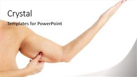  Presentation with obese - Colorful slides enhanced with obesity surgery - picture of obese adult woman backdrop and a white colored foreground