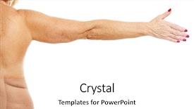  Presentation with obese - Presentation theme having obesity surgery - picture of obese adult woman background and a  colored foreground