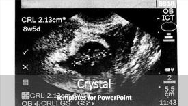  Presentation with obstetrics - Amazing PPT theme having obstetrics ultrasound - printed image of fetal measurement backdrop and a dark gray colored foreground