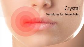 Presentation with herpes virus - Audience pleasing PPT theme consisting of ointment cream - female lips with herpes virus backdrop and a coral colored foreground