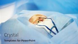  Presentation with ophthalmology - Presentation theme with ophthalmology-eye-correction-supgeon-perform background and a light blue colored foreground