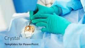  Presentation with ophthalmology - Beautiful slide deck featuring ophthalmology-eye-correction-supgeon-perform backdrop and a light blue colored foreground