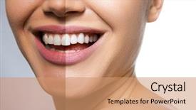  Presentation with teeth whitening - Slides consisting of care therapy and whitening background and a coral colored foreground