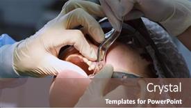  Presentation with dental implant - Slide deck having oral-surgeon-drilling-hole background and a violet colored foreground