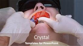  Presentation with arches - Presentation design with oral-surgeon-making-wax-up background and a violet colored foreground