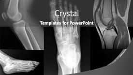  Presentation with xray - Beautiful theme featuring orthopedic-collage-of-foot backdrop and a dark gray colored foreground