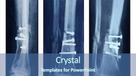 Presentation with broken leg - Colorful PPT layouts enhanced with orthopedic surgeon - broken leg collection - x-ray backdrop and a ocean colored foreground
