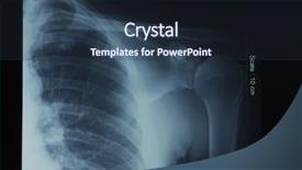  Presentation with shoulder - Cool new slide set with orthopedic surgeon - x-ray film of shoulder front backdrop and a tawny brown colored foreground