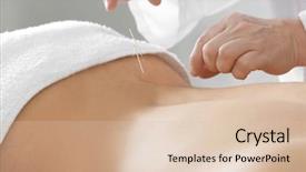  Presentation with pain points - Beautiful PPT theme featuring pain points - young man undergoing acupuncture treatment backdrop and a lemonade colored foreground