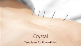  Presentation with pain points - Cool new PPT theme with pain points - young woman undergoing acupuncture treatment backdrop and a lemonade colored foreground