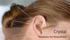  Presentation with pain points - Slide set consisting of pain points - young woman undergoing acupuncture treatment background and a coral colored foreground